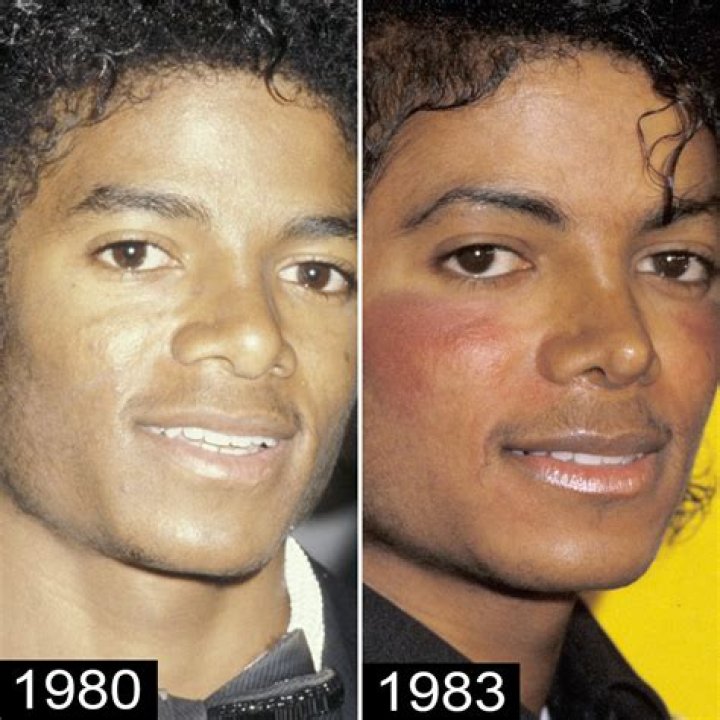 Michael Jackson Before Nose Job: A Deep Dive into His Transformative Journey