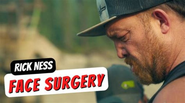 Rick Ness Face Change: Unveiling the Transformation and Its Impact