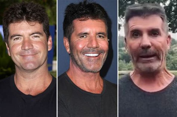 Simon Cowell's Journey: Embracing His Son's Challenges