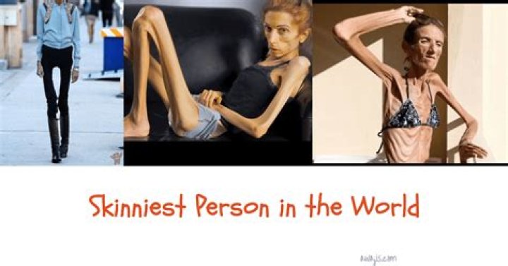 Skinniest Person Ever: Exploring the Stories, Causes, and Impacts