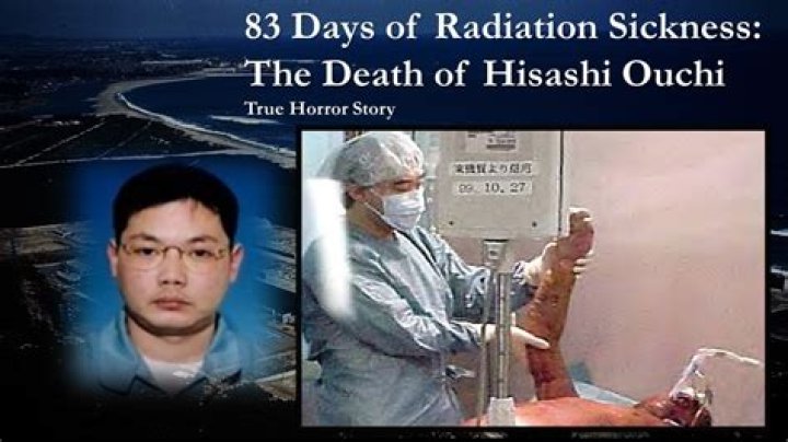 The Harrowing Story of Hisashi Ouchi: A Real-Life Tragedy of Radiation Exposure