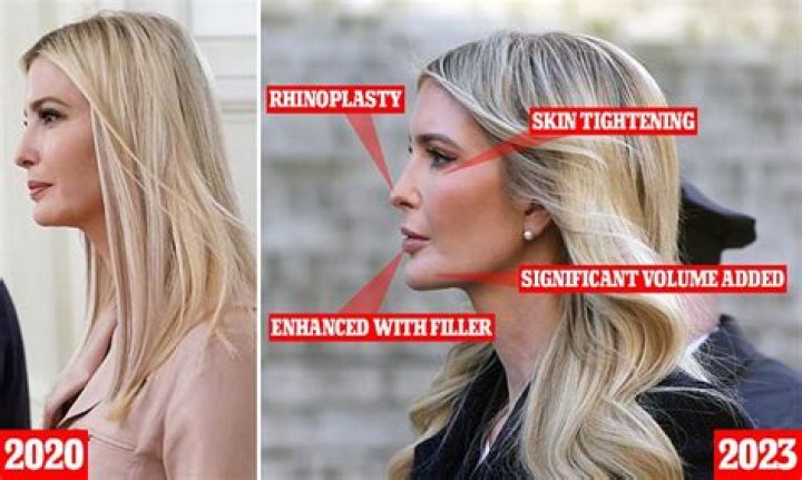 Unveiling the Truth Behind Eric Trump Plastic Surgery