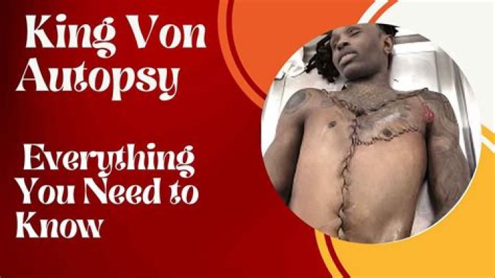 Unveiling the Truth: King Von Autopsy Revealed