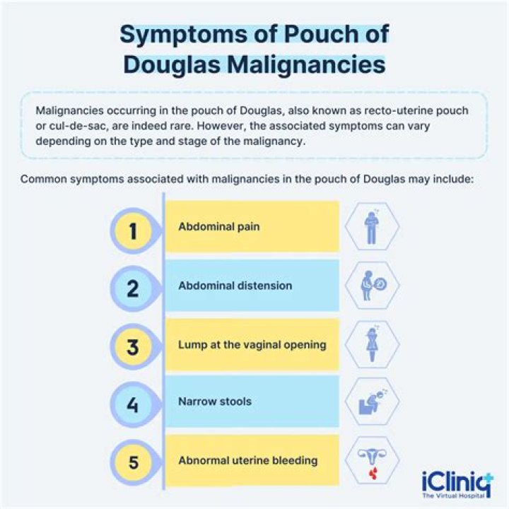What is Pouch of Douglas: A Comprehensive Guide to Understanding its Anatomy and Importance