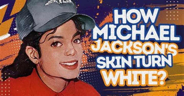Why Did Michael Jackson's Skin Color Change? Unveiling the Truth Behind the Transformation